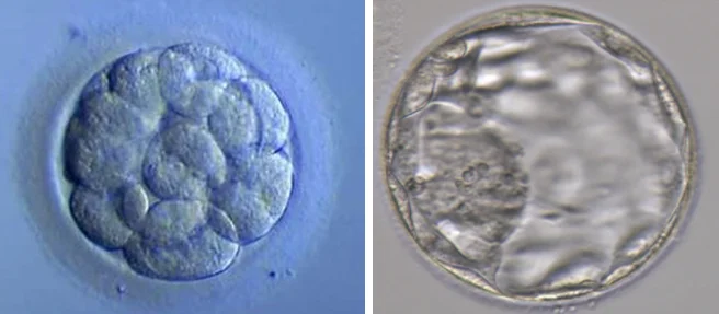 Embriões 2