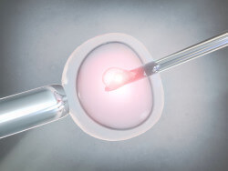 Como o cross-match auxilia tratamentos de fertilidade?