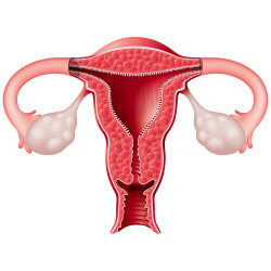 Como a anatomia do útero interfere na fertilidade?