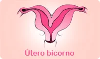 utero-bicorno-e-a-fertilidade-feminina