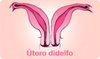 utero-didelfo-e-a-fertilidade-feminina