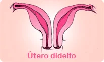 utero-didelfo-e-a-fertilidade-feminina