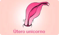 utero-unicorno-e-a-fertilidade-feminina