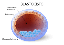 Transferência do blastocisto: entenda como funciona