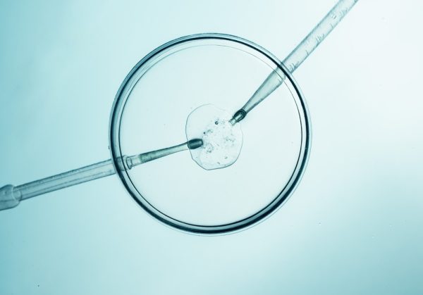 Técnica de Fertilizando in Vitro