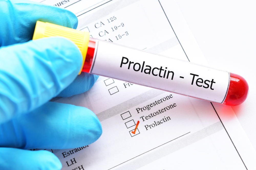 Como a disfunção da prolactina afeta a infertilidade?