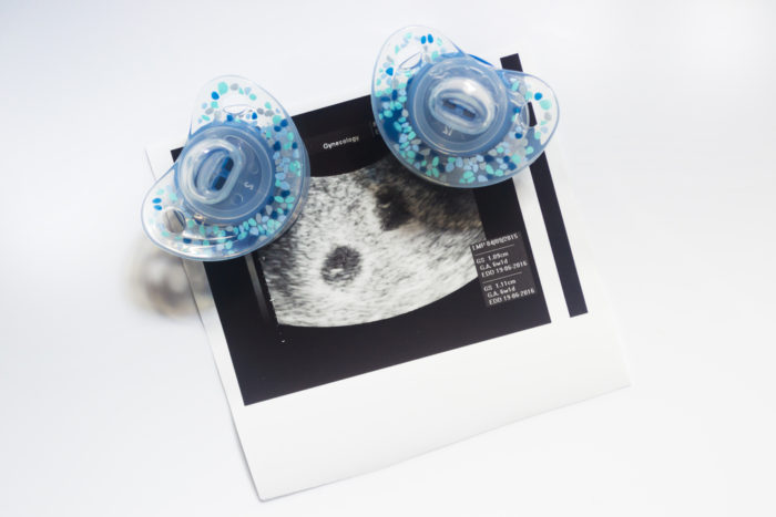 Como engravidar de gêmeos: ultrassom