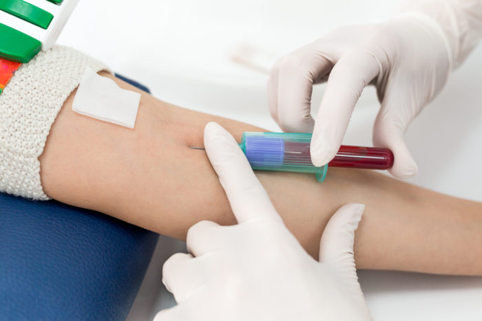 Exame de sangue para medir a reserva ovariana