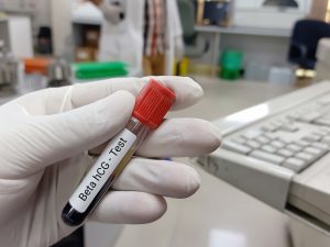Beta HCG: Conheça o exame e saiba como entender o resultado