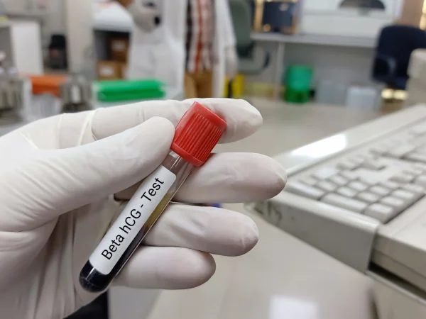 Mão segurando uma amostra de sangue para exame de beta hcg