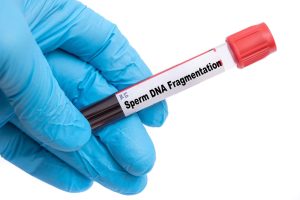 Entenda sobre a fragmentação do DNA espermático