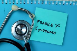 Falência ovariana prematura (FOP): a síndrome do X frágil