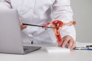 Ligamentos uterossacros: o que são e qual sua relação com a endometriose