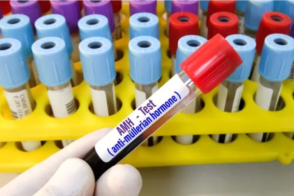 Tubos de ensaio contendo material para exame. No primeiro plano, há um tubo de ensaio com a identificação "AMH - Test (anti-mullerian hormone)".