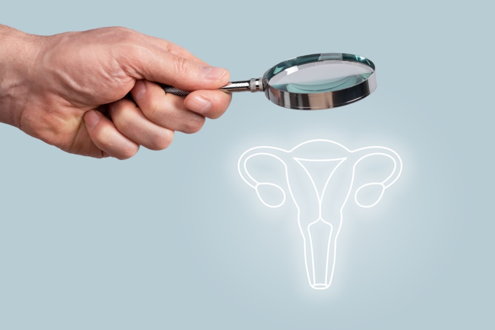 Istmocele: qual sua relação com a infertilidade secundária?