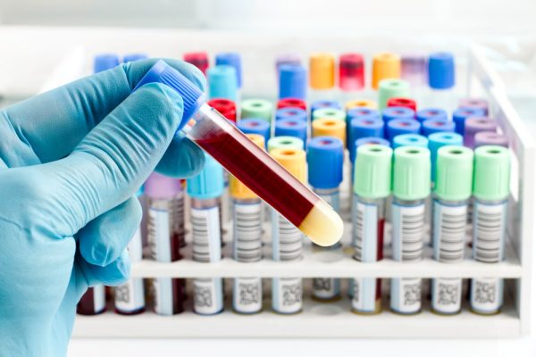 Mão com luva segurando tubo de sangue