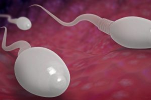 O que é a teratozoospermia?