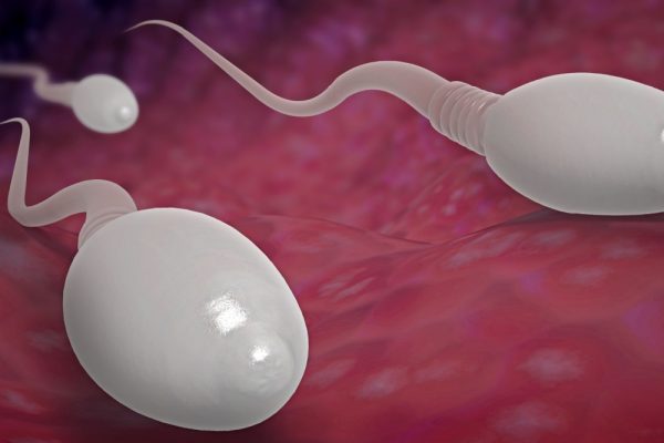 O que é a teratozoospermia?