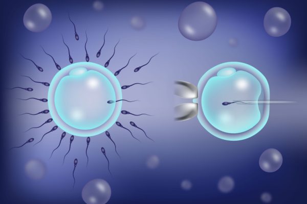 FIV clássica e FIV por ICSI: quais as diferenças?