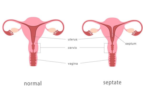 Imagem ilustrativa de úteros