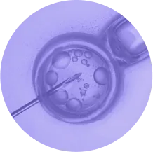 Fertilização In Vitro (FIV)