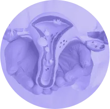 Inseminação Artificial