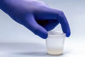 Espermograma: como é realizado o exame?