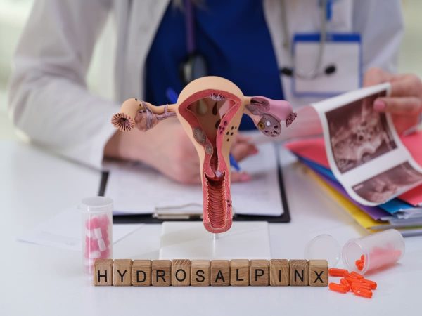 Ilustração de útero e trompas de falópio com texto hidrossalpinge e médica ao fundo explicando a condição