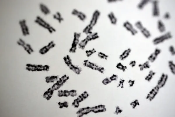 Imagem de vários cromossomos ilustrando tema sobre trissomia-16 em artigo de fertilidade
