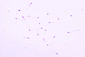 Como alterações morfológicas dos espermatozoides afetam a fertilidade masculina