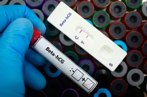 Valores do beta hCG após a FIV: quando fazer o teste?