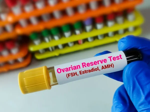 Frasco com rótulo de FSH, Estradiol e AMH representando testes para avaliar a reserva ovariana.