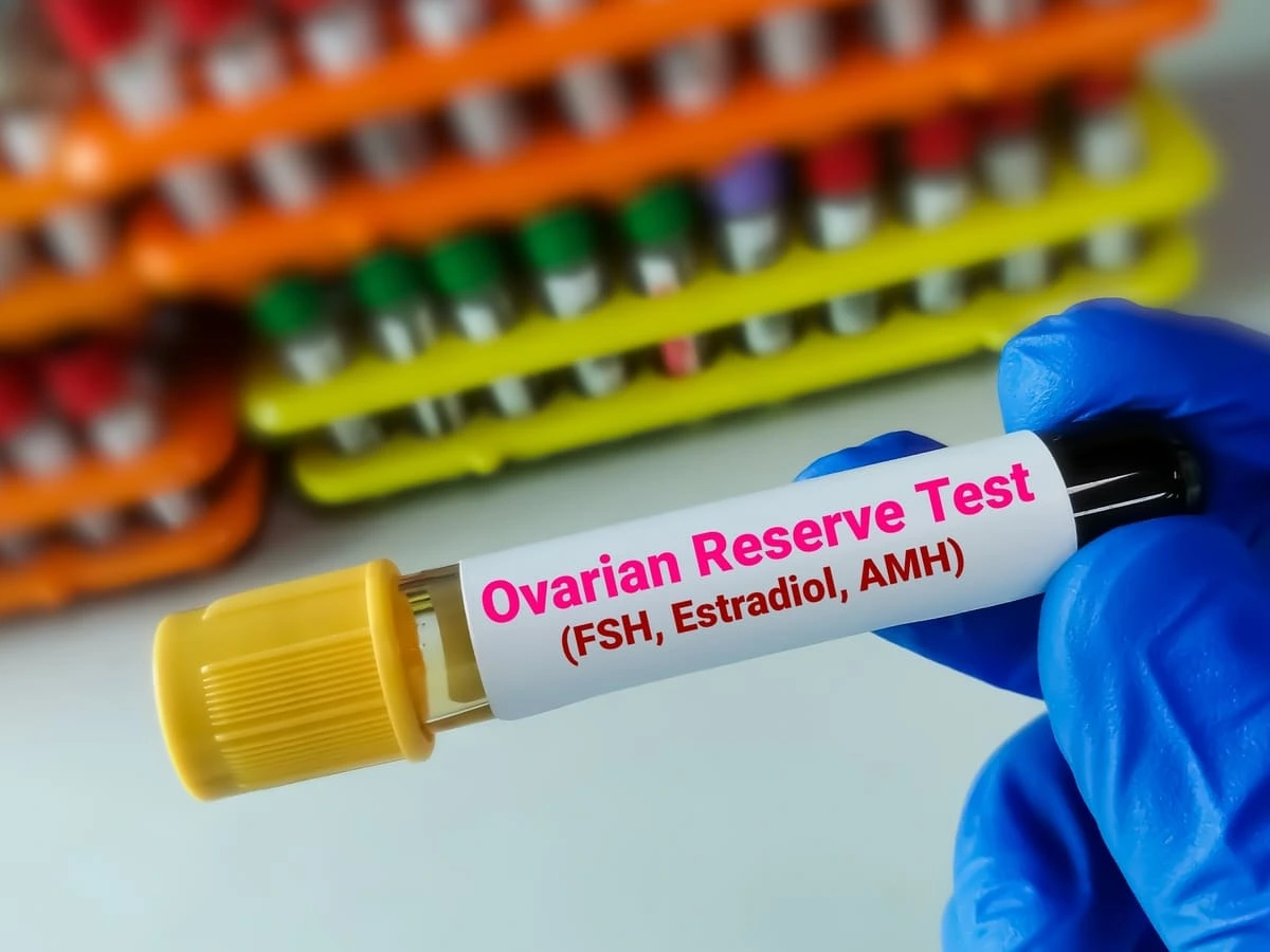 O que é reserva ovariana?