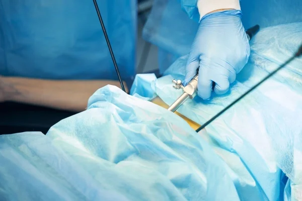 Médica realizando histeroscopia em paciente