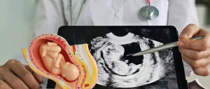 Fertilização in vitro e câncer infantil: o que realmente se sabe sobre essa relação?