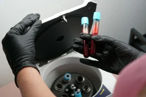 PRP na fertilidade: o que é, quando pode ser indicado e o que dizem as evidências